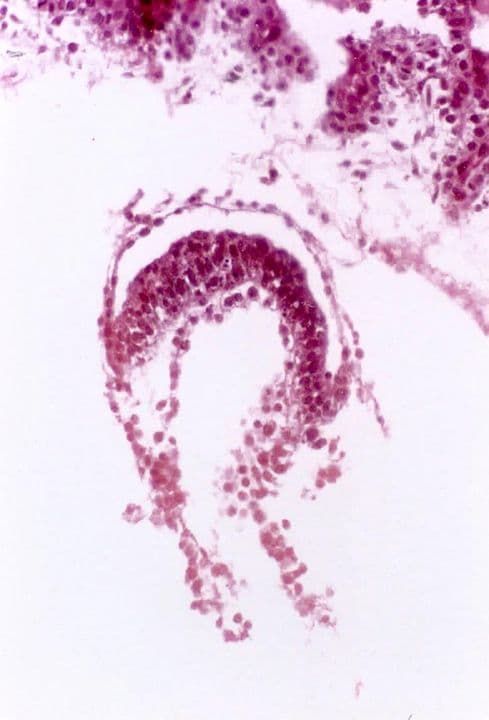 Ultrasound image at pregnancy week 4