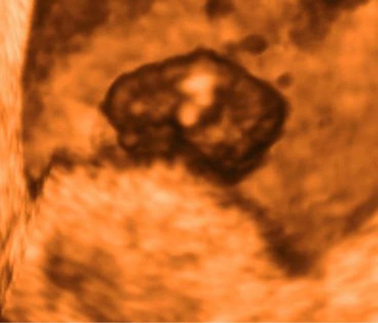 7 weeks and 5 days pregnant