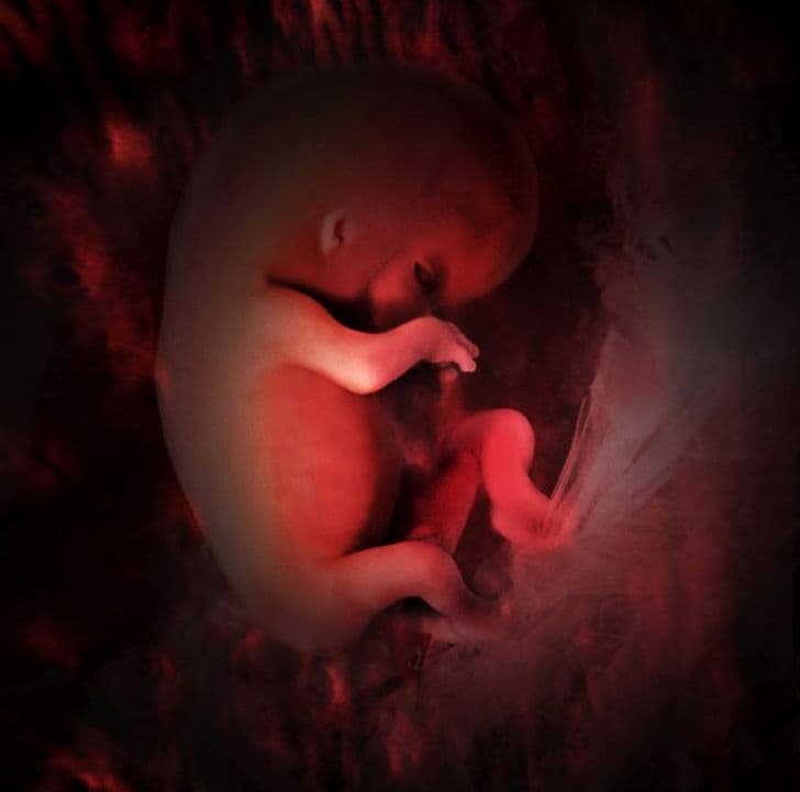 Ultrasound image at pregnancy week 10
