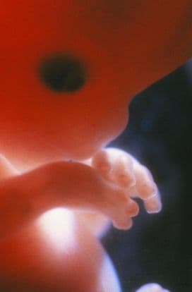 11 weeks and 5 days pregnant