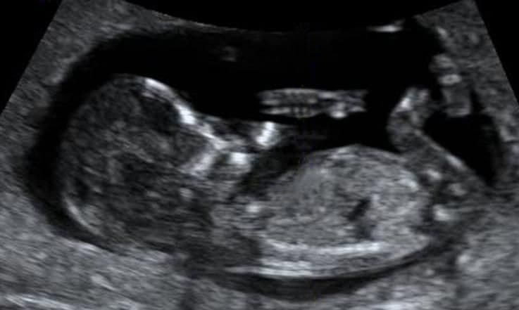 14 weeks and 6 days pregnant