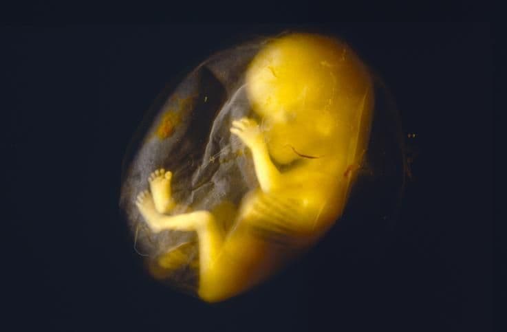 Ultrasound image at pregnancy week 19