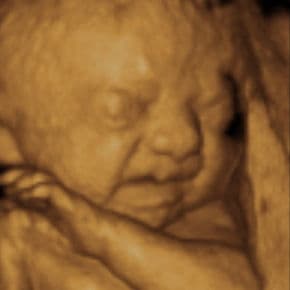 26 weeks and 7 days pregnant