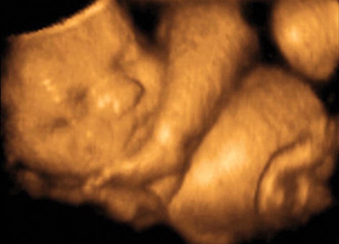 33 weeks and 5 days pregnant