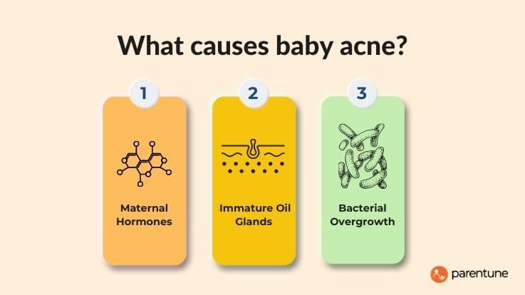 What Causes Baby Acne?