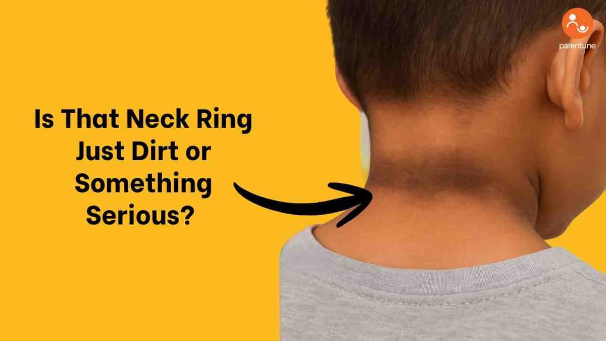 Neck Riing Is That Neck Ring Just Dirt or Something More? Child Skin Patch May ...